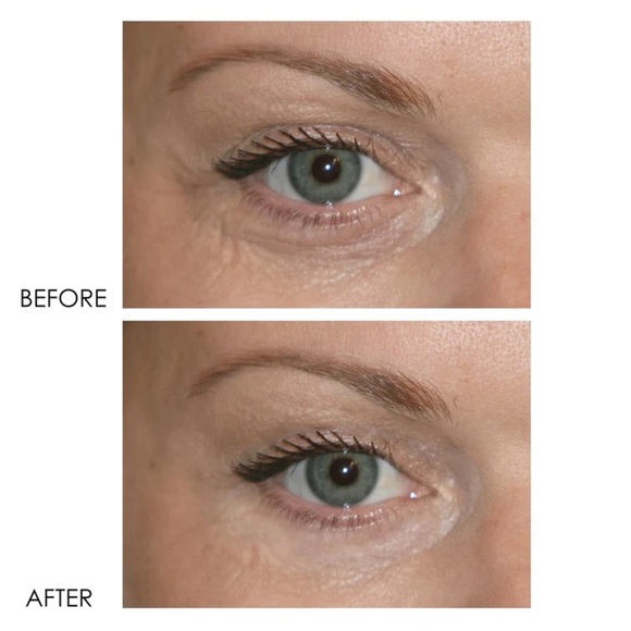 dERmELCT Eyelid & Dark Circle Corrector Professional Strength - Picture 12 of 15